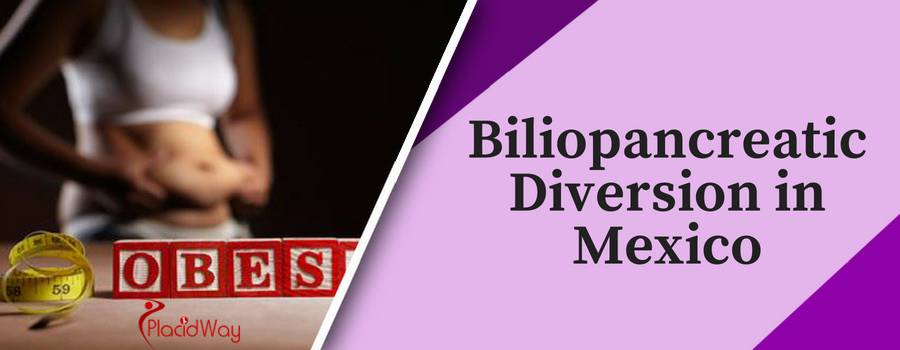 Biliopancreatic Diversion in Mexico